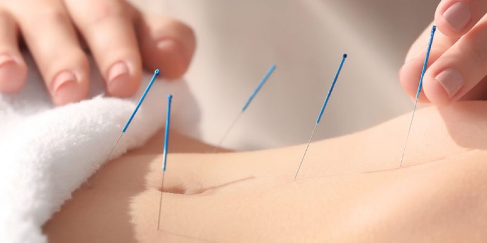 Guide en ligne sur l’art de l’acupuncture