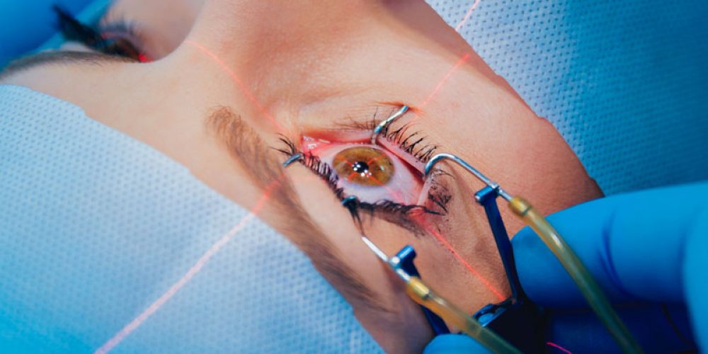 Chirurgie des yeux : choisir un bon spécialiste en ligne